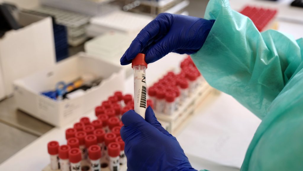 2020 05 12 superplasma, si può sperimentare anche a Fermo