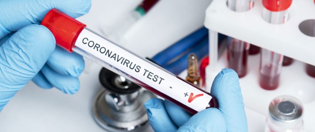 Operazione Marche sicure: screening domani a Recanati, poi a Castelraimondo e a Pieve Torina