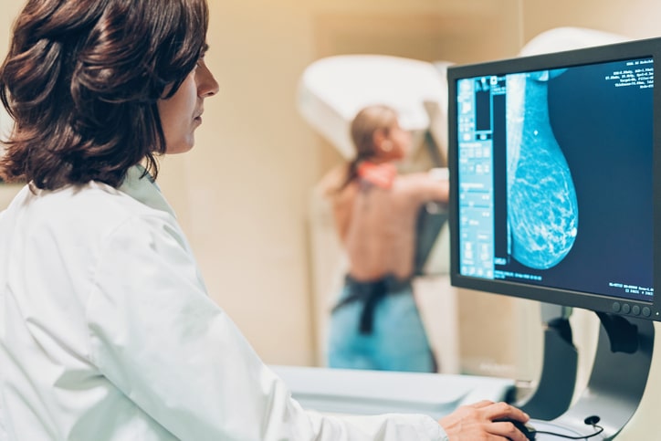 Screening mammografico gratuito: l’invito esteso dall’AST Fermo